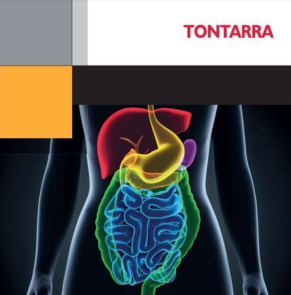 Tontarra_laparoscopy